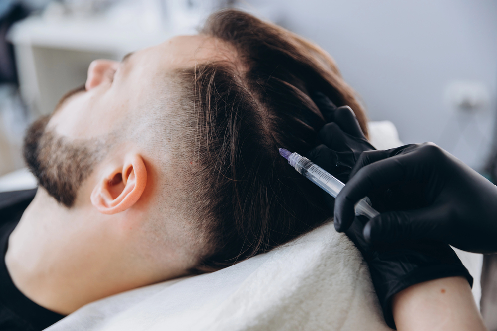 What Is Hair Mesotherapy