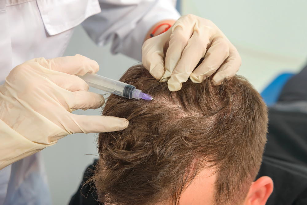 Who Is Hair Mesotherapy Best For