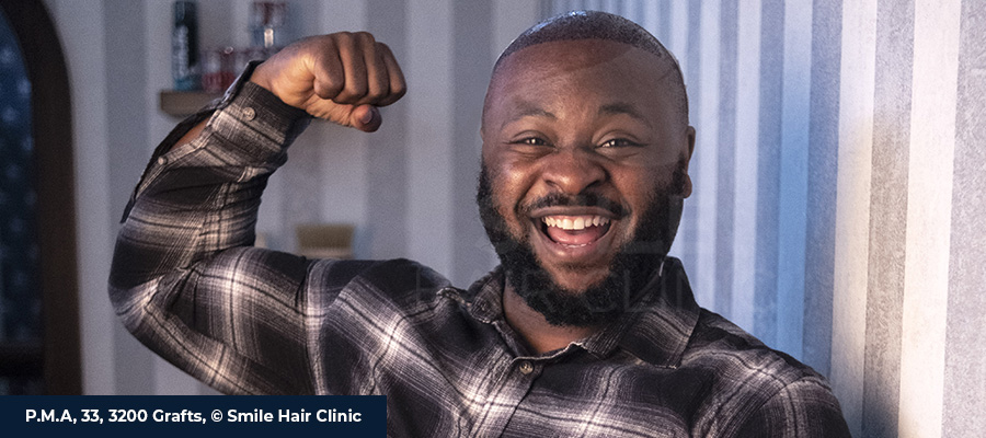 Afro Hair Transplant
