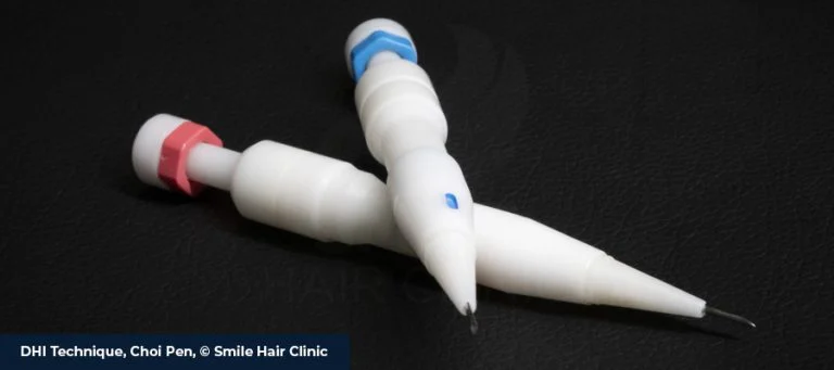 How Is DHI Different From Sapphire FUE