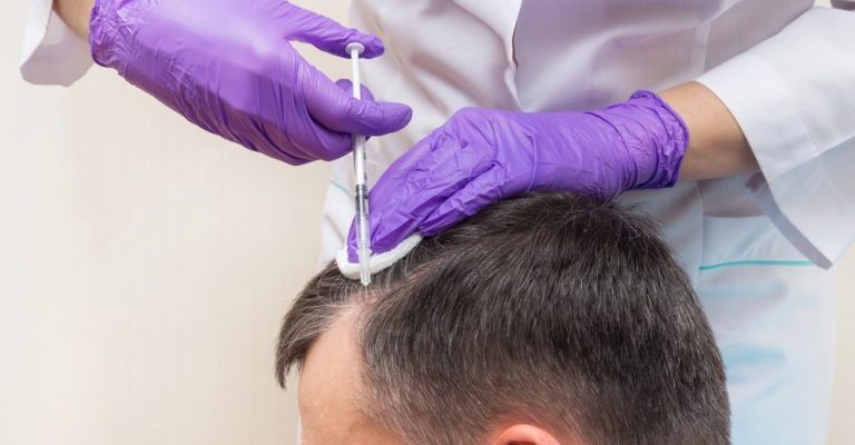 PRP Hair Treatment