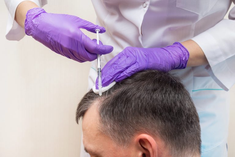 PRP Hair Treatment
