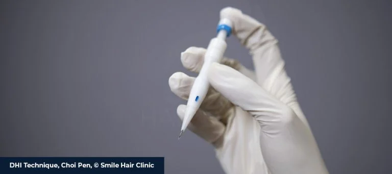 What Is DHI Hair Transplant