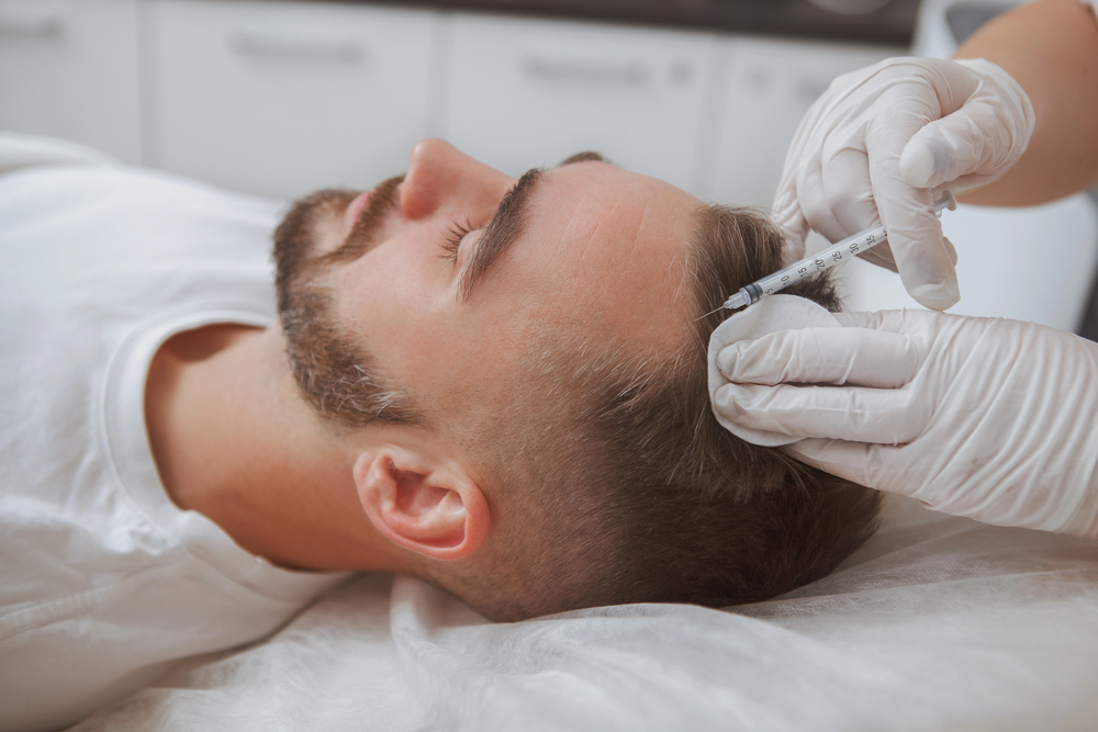 What Is PRP Hair Treatment
