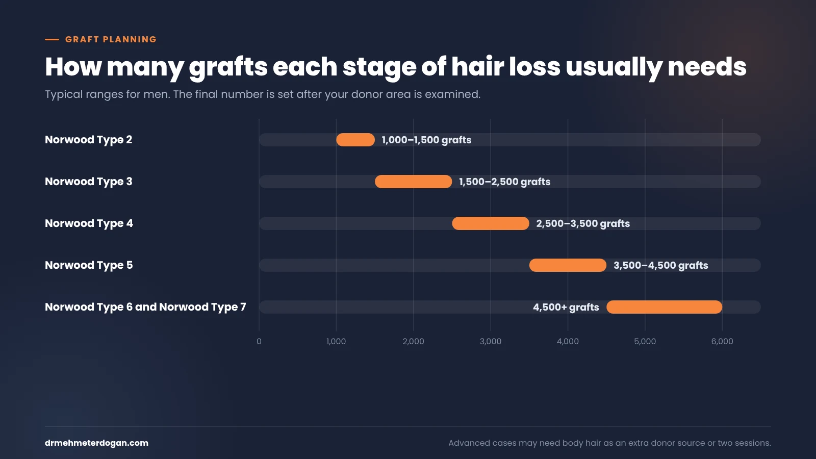 Typical number of grafts needed for each Norwood Type of hair loss
