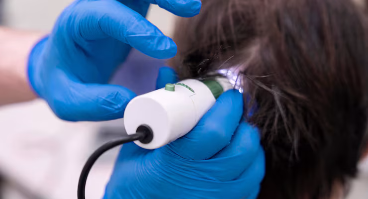 Ozone Hair Therapy Turkey