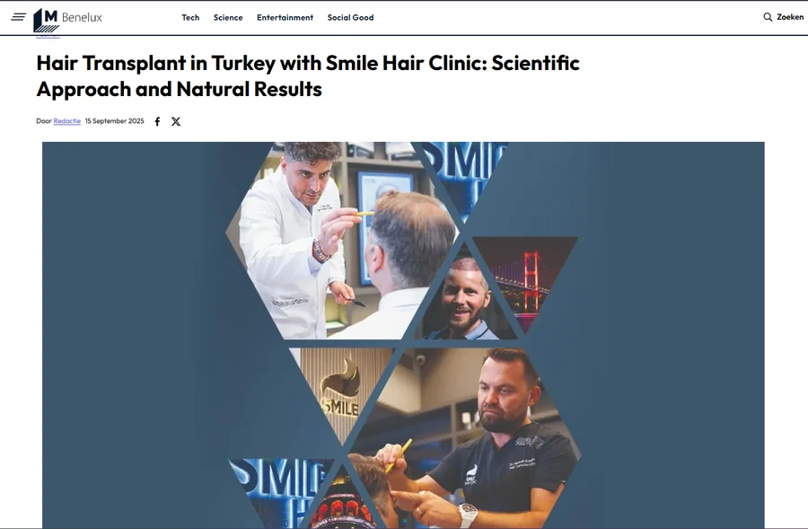 Mashable Benelux article on hair transplant in Turkey with Smile Hair Clinic